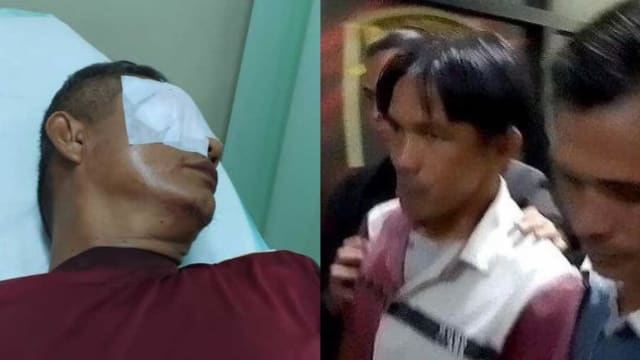 不满儿子被处罚 印尼家长弹弓射老师至其右眼全盲