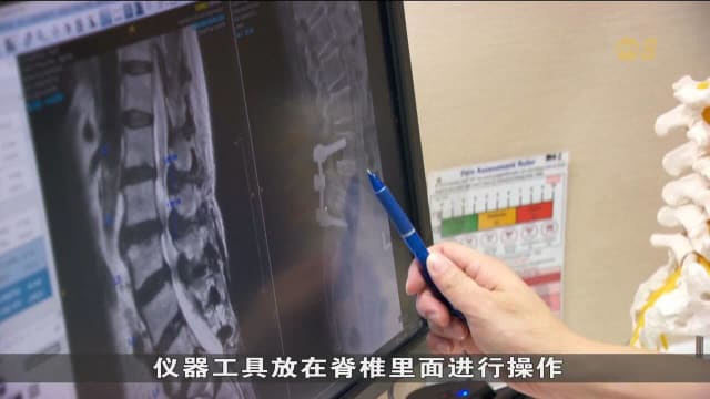 国立健保集团医院推出窥镜脊柱手术一年来 100多个病人已受益