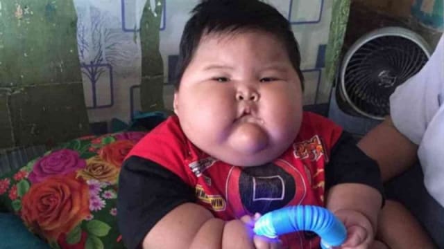 穿爸爸的衣服！印尼16个月大巨婴重27公斤！