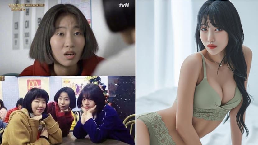 lee_se_young_plastic_surgery_reply_1988_b.jpg