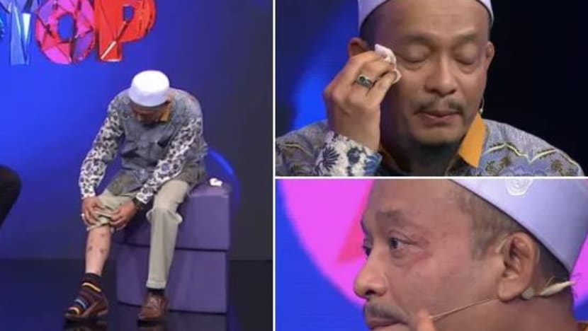 Ustaz Kazim Elias tanggalkan solekan ketika siaran langsung, tunjuk kesan penyakit misteri
