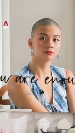 The 29-year-old who spent 12 years grappling with a hair-pulling disorder