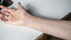 Related article image