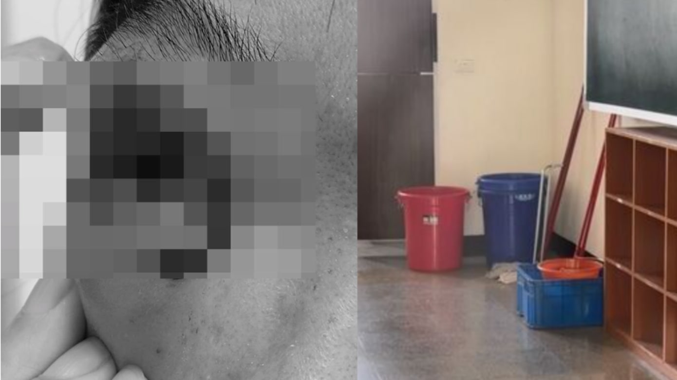 不满被叫回座位 台中小六生挥扫把打老師脸部溅血恐失明