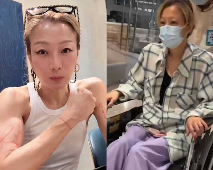 Hong Kong star Sammi Cheng recovers from back muscle injury after gym workout
