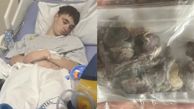 吸食三年肺部变黑险丢命 17岁少年：永不再碰电子烟