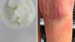 Related article image