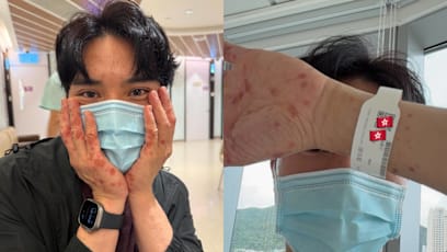 Severe Allergic Reaction To Suspected Insect Bites Lands TVB Actor In Hospital During Holiday In France