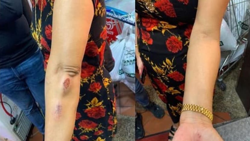 PM Lee and several ministers speak out against alleged racist attack on woman along Choa Chu Kang Drive