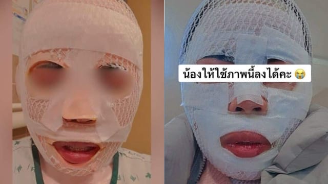 韩男深夜泼滚烫热水毁容女友  称“变丑才不会被抢走”