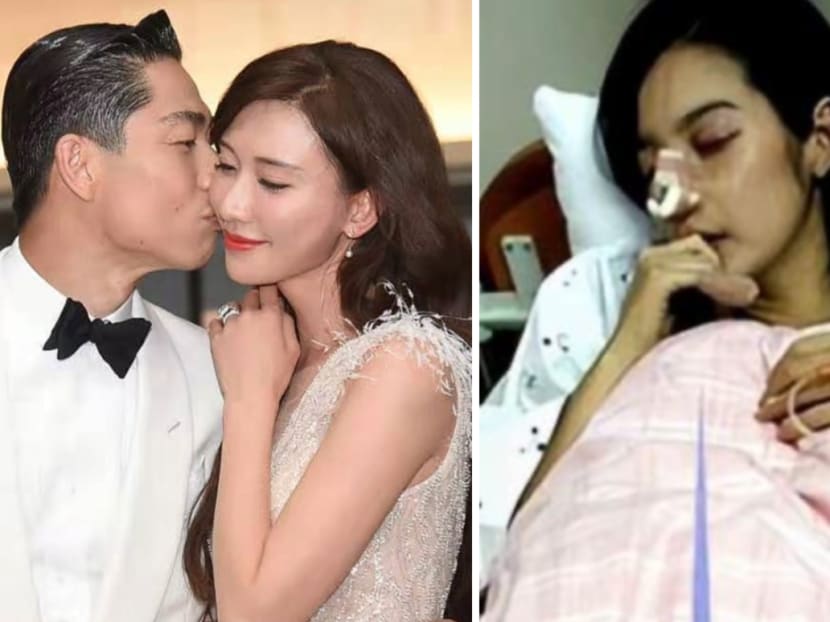 Photo of an abused Lin Chiling turns out to be fake; woman in pic is another actress, who was really abused by her husband