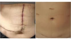 Related article image