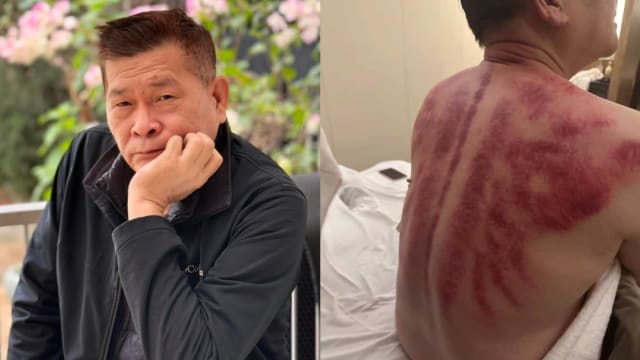 为还债赴中国大陆拍戏　澎恰恰深夜晒照“背后一片红”