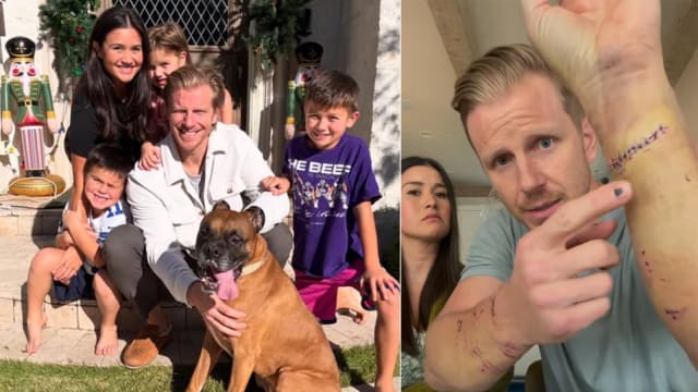 “Bachelor”男星遭家犬疯狂袭击，紧急送院治疗
