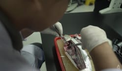 Plastic for dinner? Why Southeast Asians may have the most microplastics in their bodies