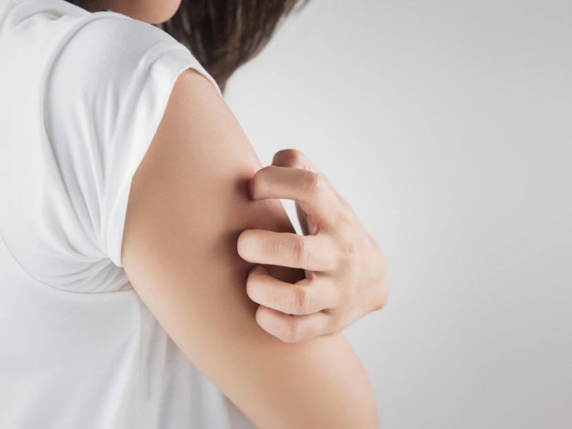 Why do you suddenly feel itchy? Why does scratching feel good? We answer your itch-related questions Why do you suddenly feel itchy? Why does scratching feel good? We answer your itch-related questions