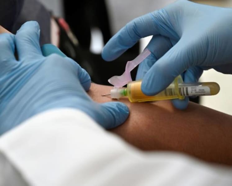Community blueprint launched in bid to end HIV transmission, AIDS in Singapore by 2030