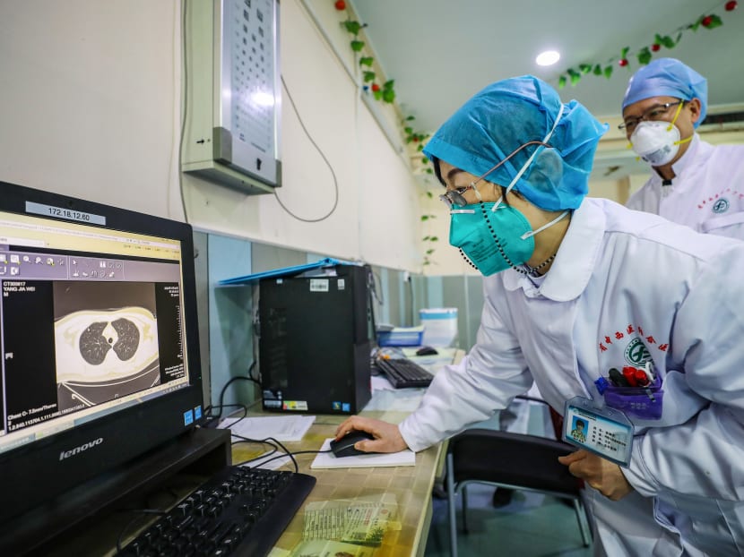 A doctor wearing a facemask looking at a scan of lung from a patient at a hospital in Wuhan in China's central Hubei province, during the coronavirus outbreak in the city, on Jan 30, 2020. A doctor wearing a facemask looking at a scan of lung from a patient at a hospital in Wuhan in China's central Hubei province, during the coronavirus outbreak in the city, on Jan 30, 2020.