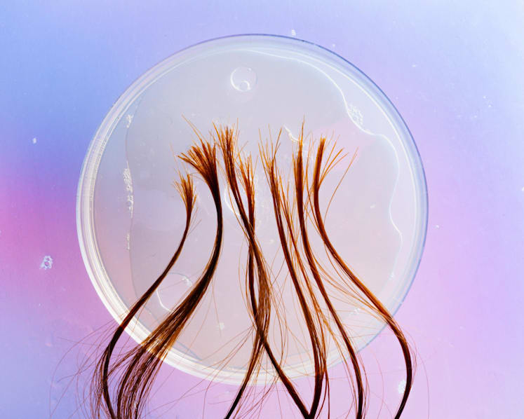 What your hair says about your health, according to science What your hair says about your health, according to science