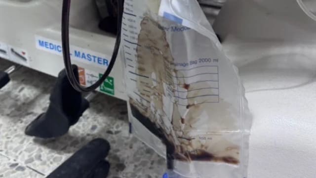 迟交作业被罚深蹲200次 泰国学生肾功能受损