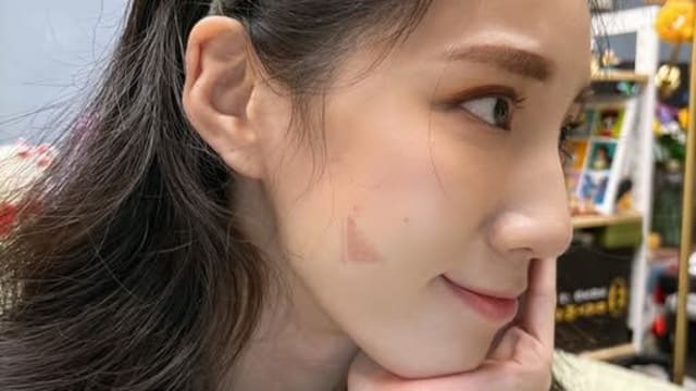 过年前破相！女星高温烙印“右脸惨烧焦”