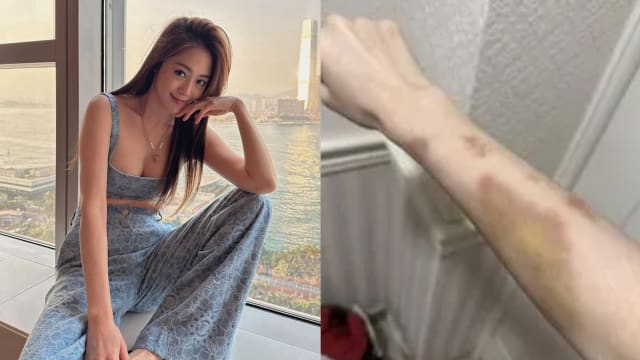 台湾名媛林千又被男友家暴送医