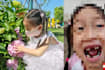 5-Yr-Old Girl Loses 4 Teeth After Robot Kicks Her In The Face During Science Museum Visit, May Be Left With Permanent Scar