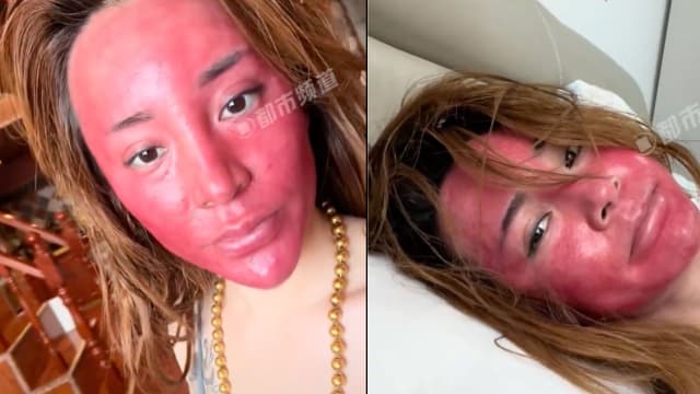 22年化妆不卸妆 中国女子脸红成“关公”