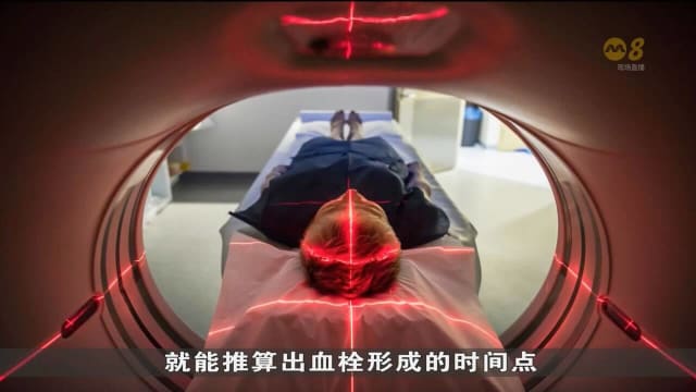 先进图像技术协助医生 在黄金时间窗口为中风者施药