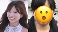 24-Yr-Old Ex Japanese Idol Reveals She Has Spent S$48K On Cosmetic Surgery Since She Was 12