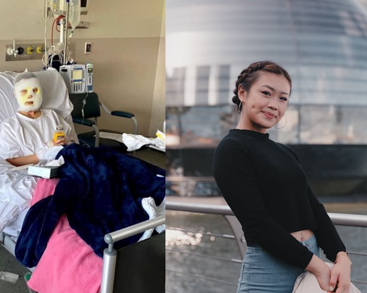 This Singaporean burn survivor is so inspiring a Kardashian called her a 'queen'