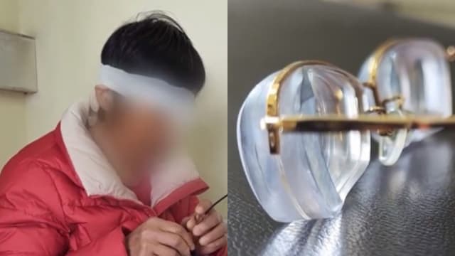 近视达3000度 中国女子痛失眼球