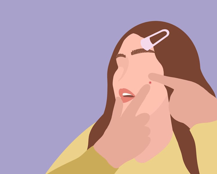 What is stress acne and how do you deal with it? Is that why you keep getting zits before an important event? 