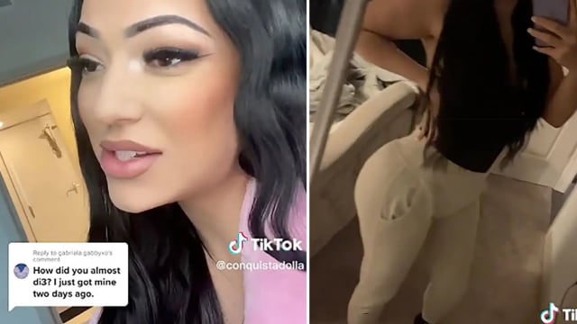 丰臀手术失败险丢命 女网红：里面全烂了