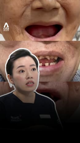 What does tooth loss have to do with brain health?