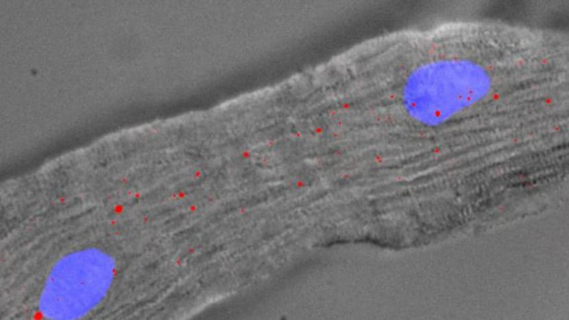 S’pore scientists find way to help heart cells repair themselves