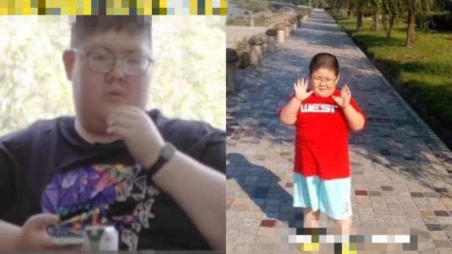 中国男孩患罕见病“永远喂不饱” 母亲：改变不了就陪他长大
