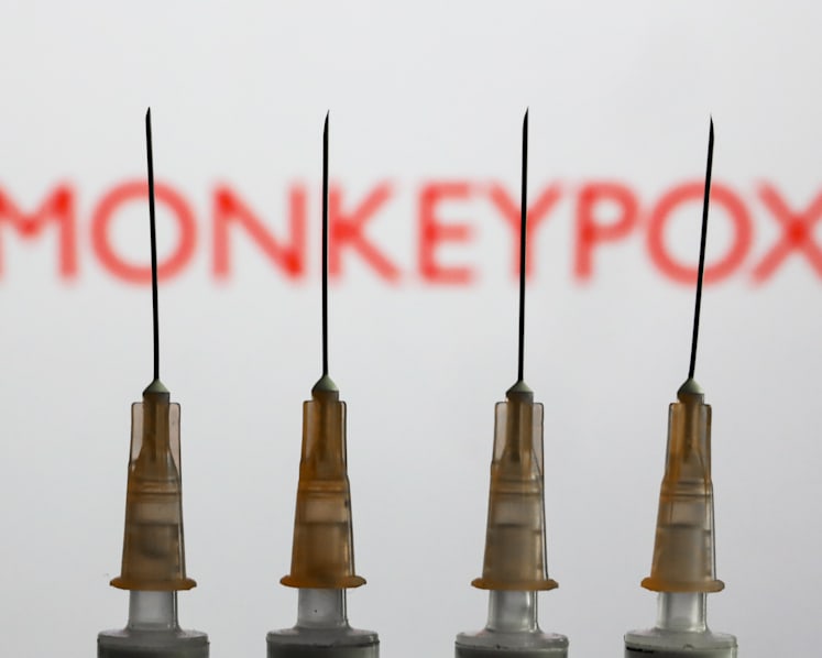 Monkeypox could be detected in Singapore in coming weeks, but unlikely to be a pandemic: Ong Ye Kung