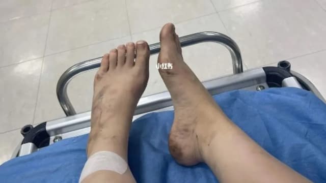 女子忆述恐怖经历 梨泰院幸存者：像人间地狱