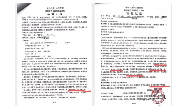 中国老汉脑梗去世 揭露医生故意隐瞒未植入支架 
