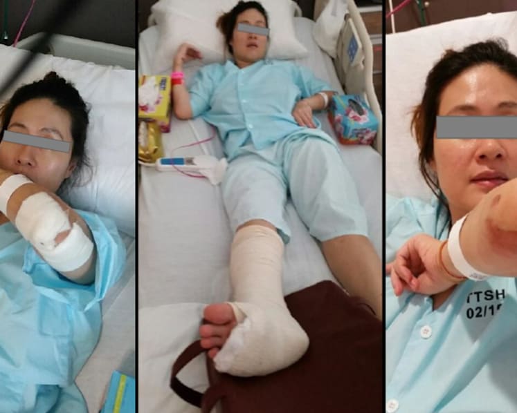 Woman who fell into manhole at Kovan sues PUB for S$5 million, claims accident caused schizophrenia
