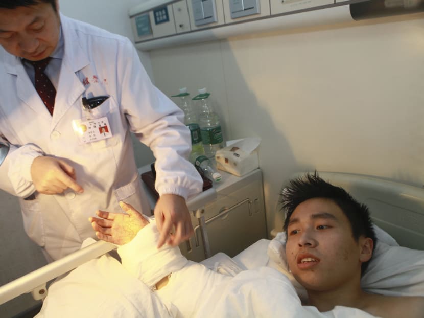 Severed hand stitched on man’s ankle to keep it alive