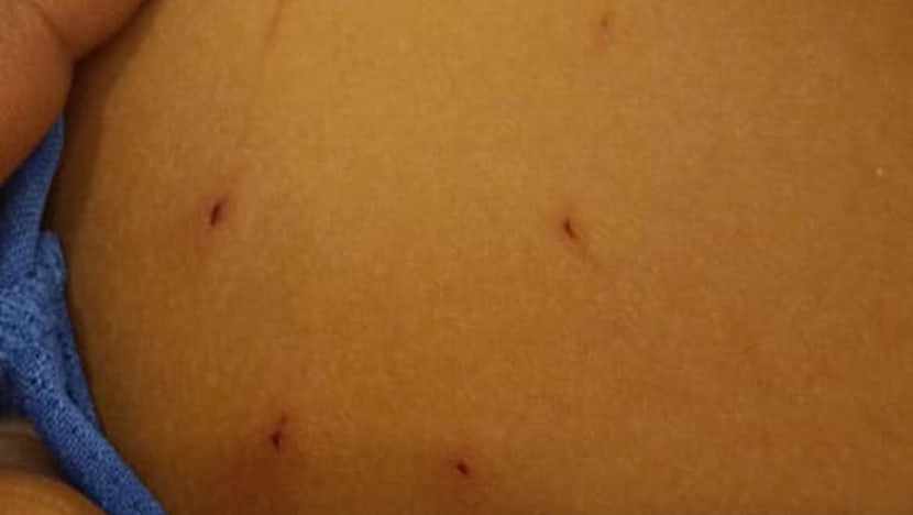 Related article image