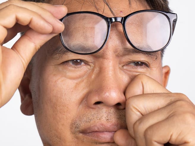 Myopia now, glaucoma later? The hidden link explained and how to reduce your risk