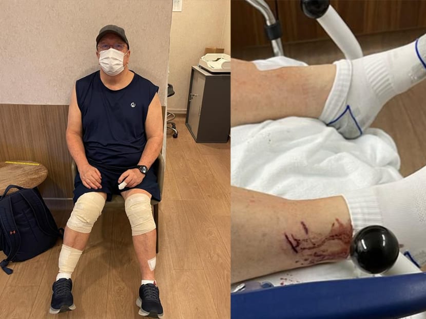 Mr Graham George Spencer (pictured) received treatment at Gleneagles Hospital after being bitten by otters at Singapore Botanic Gardens on Nov 30, 2021.