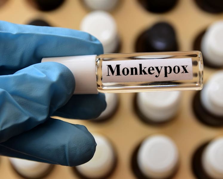 No local close contacts of Singapore's 11 monkeypox cases have tested positive for the virus: MOH