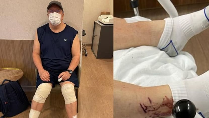 Pengunjung ke Kebun Bunga Singapura digigit memerang 26 kali; insiden seumpama itu 'jarang berlaku'