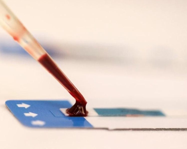 Man lied about sex history before donating HIV-contaminated blood