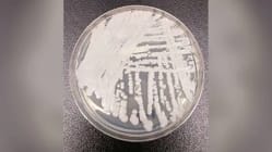 Related article image